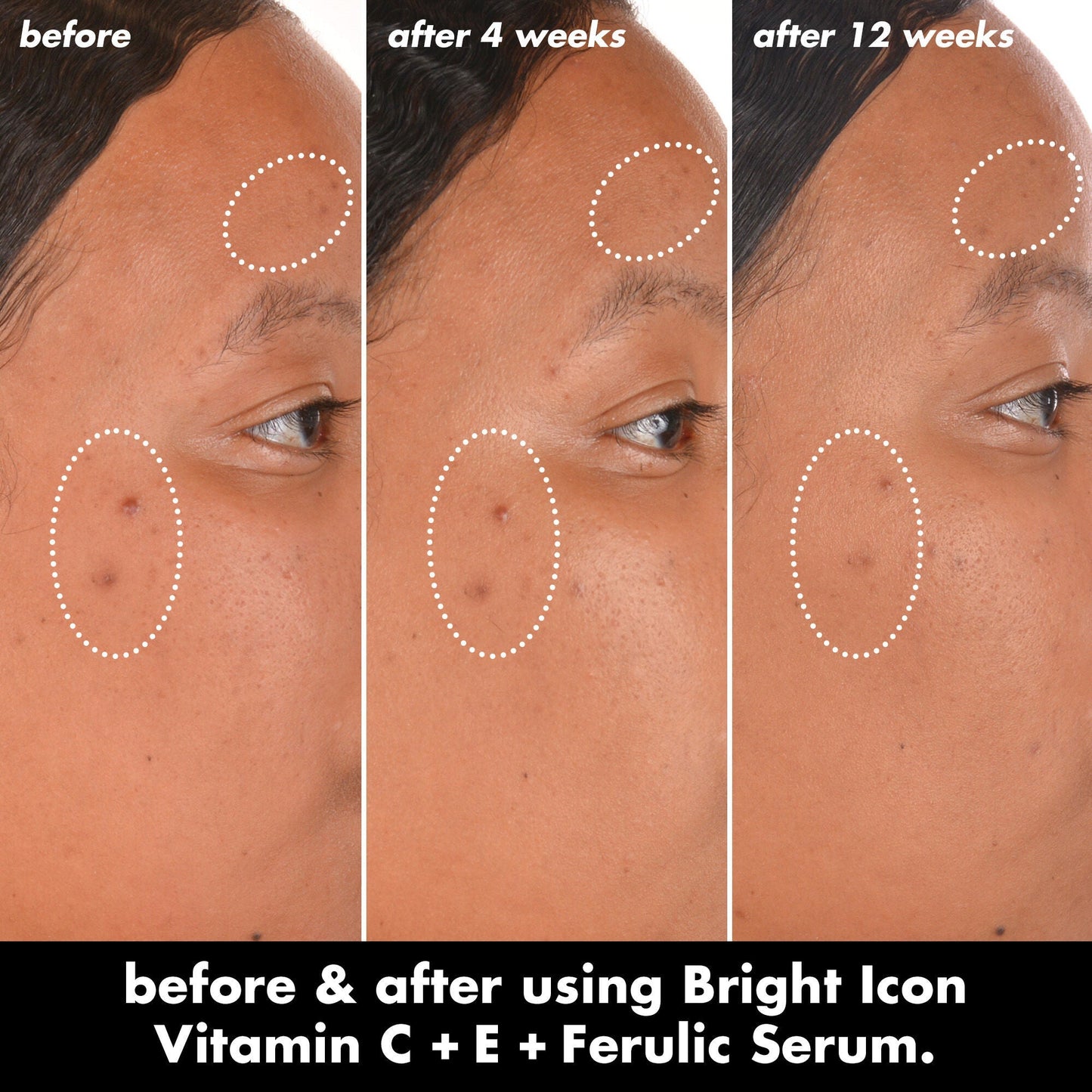 bright-icon-vitamin-c-e-ferulic-serum-c8 0226_EDU_BrightIconVitC_BA_Chanel_TRIPTYCH_c58f2fc8-209d-414f-9ba3-666a07a94887.jpg