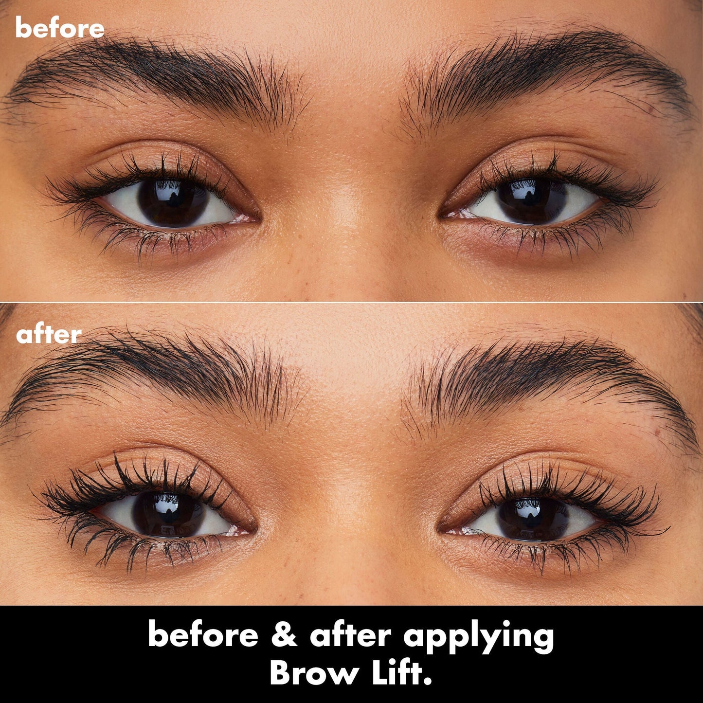 brow-lift-w1 0326_EDU_BrowLift_BA.jpg