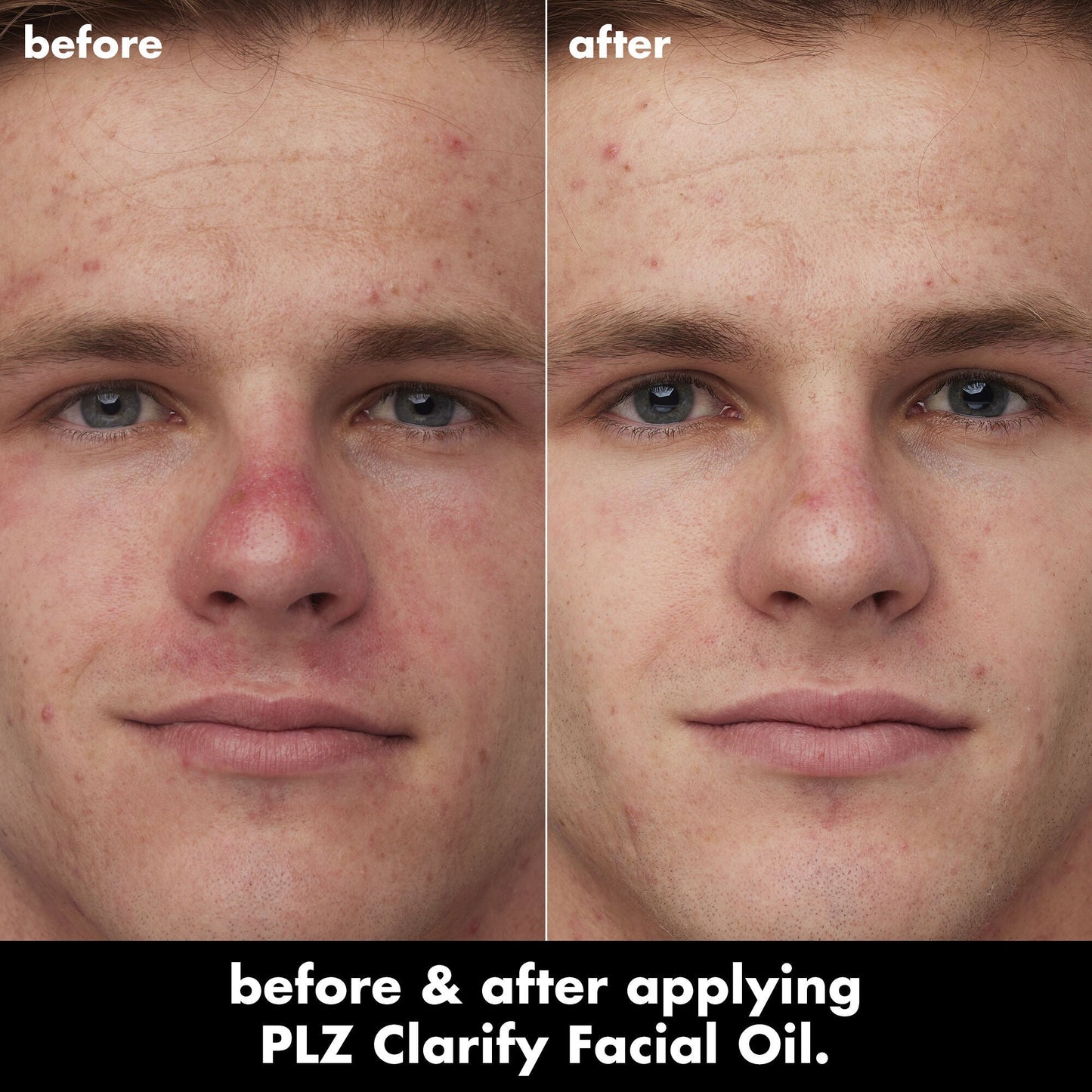 plz-clarify-facial-oil-m5 0326_EDU_PlzClarify_BA_Caleb.jpg
