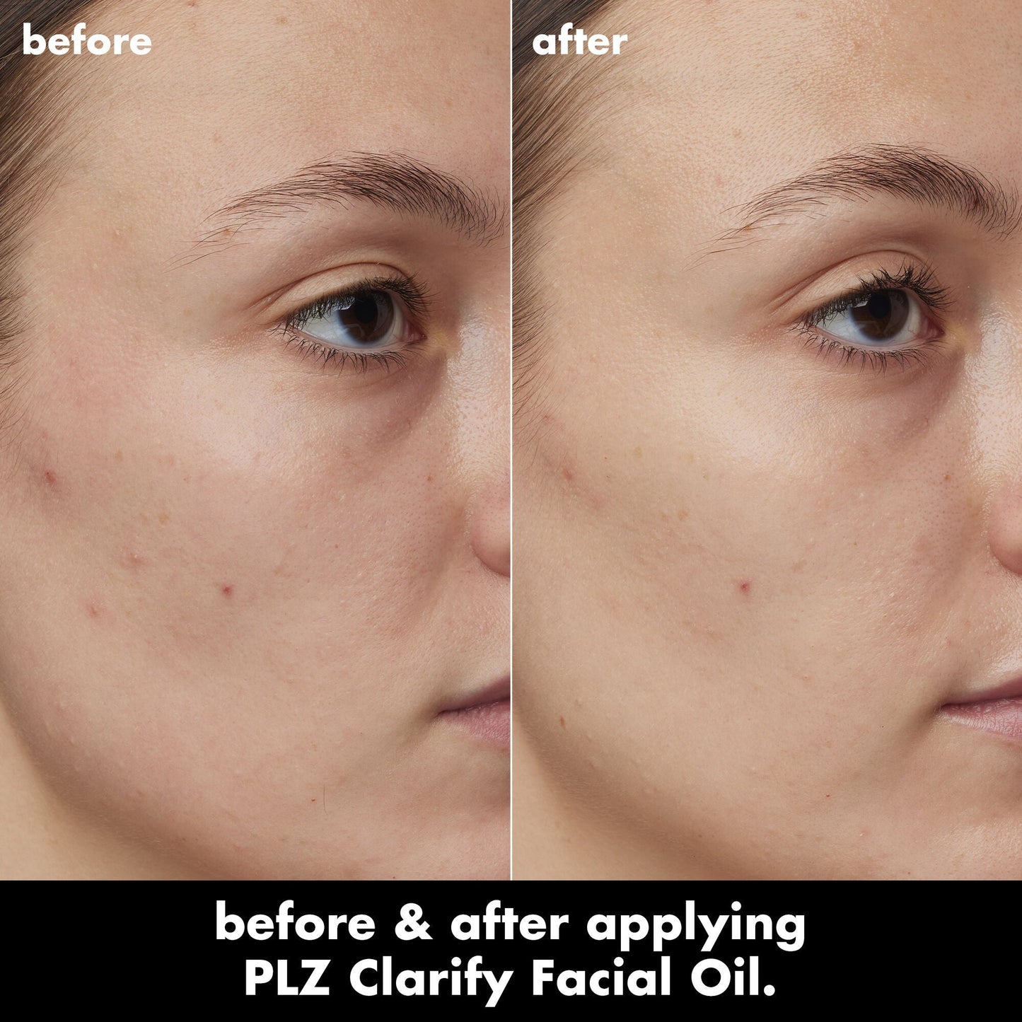 plz-clarify-facial-oil-m5 0326_EDU_PlzClarify_BA_Kelly.jpg
