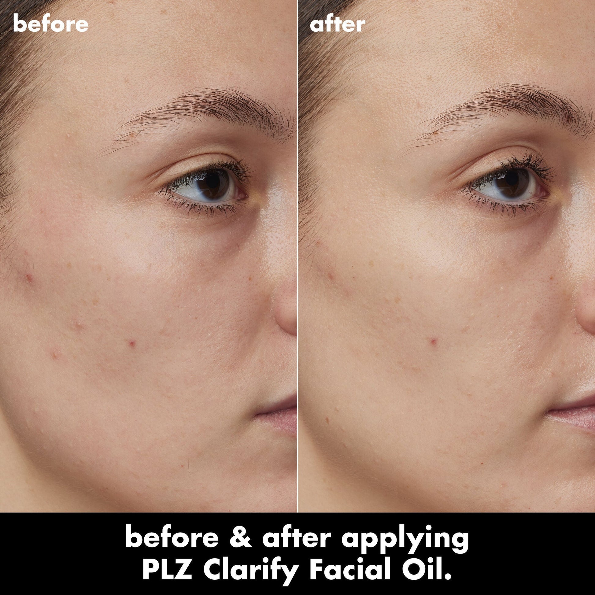 plz-clarify-facial-oil-m5 0326_EDU_PlzClarify_BA_Kelly.jpg