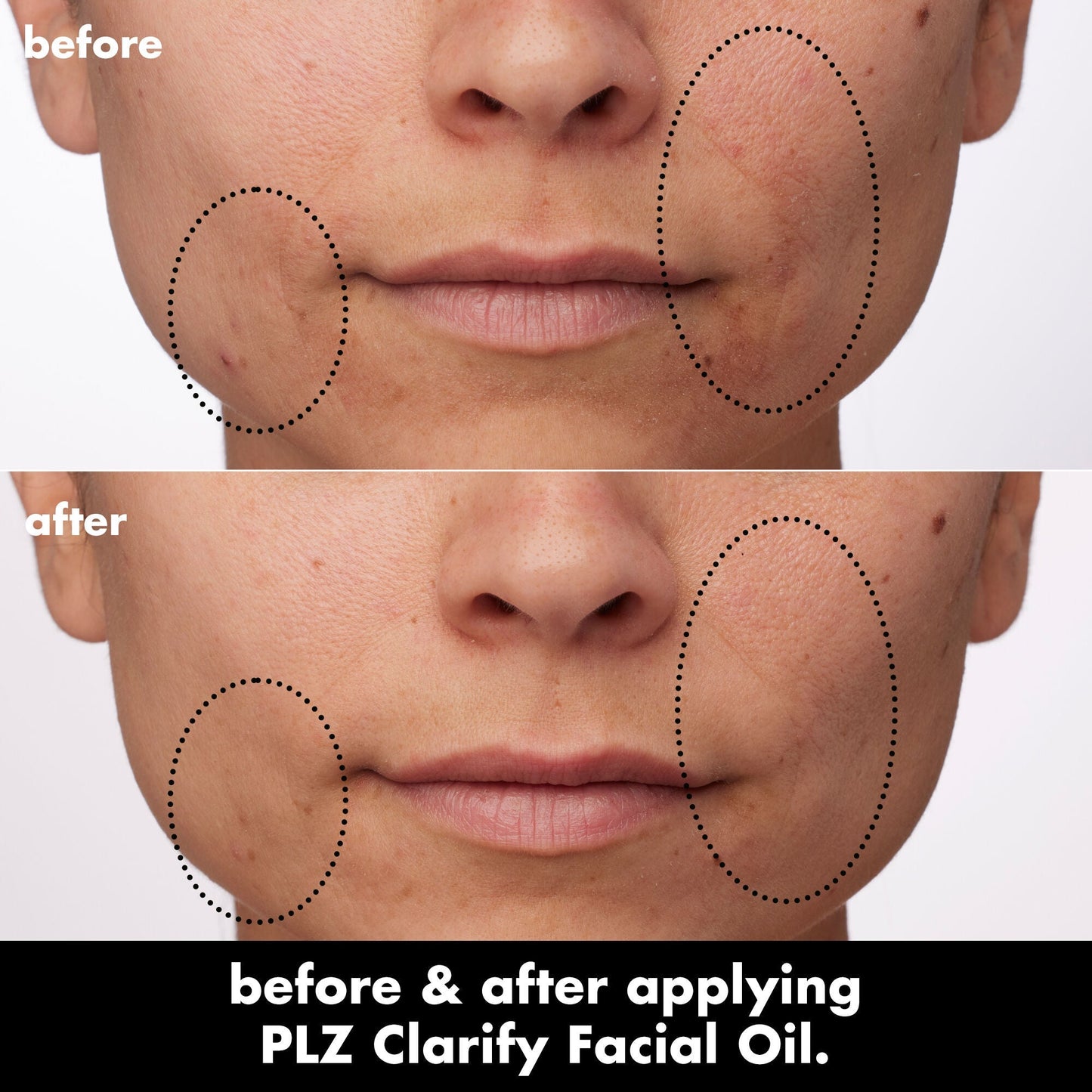 plz-clarify-facial-oil-m5 0326_EDU_PlzClarify_BA_Paula.jpg