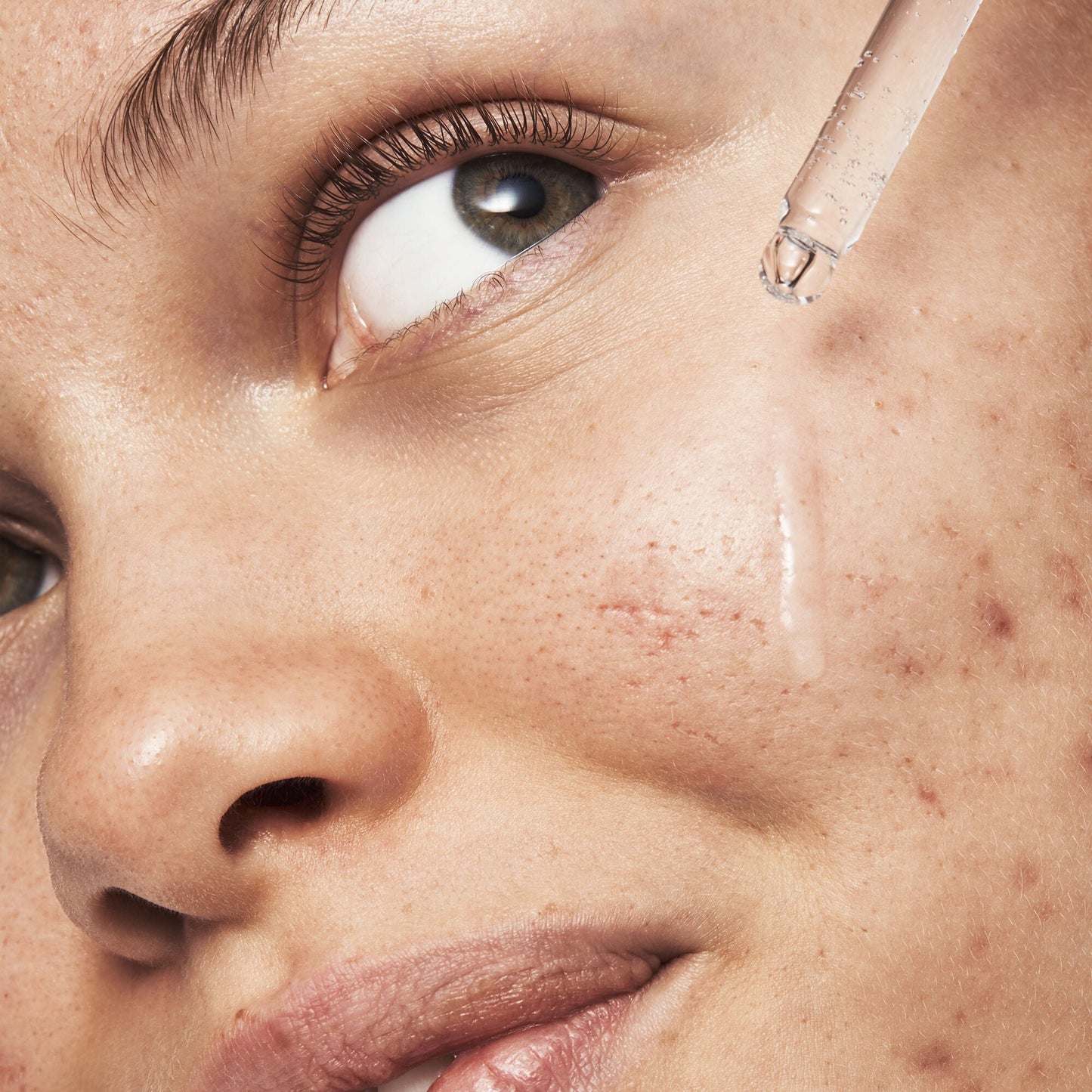 blemish-breakthrough-triple-acid-resurfacing-serum-u2 121321_Marley-Acne-Regimen_0254_FINAL_IGF.jpg