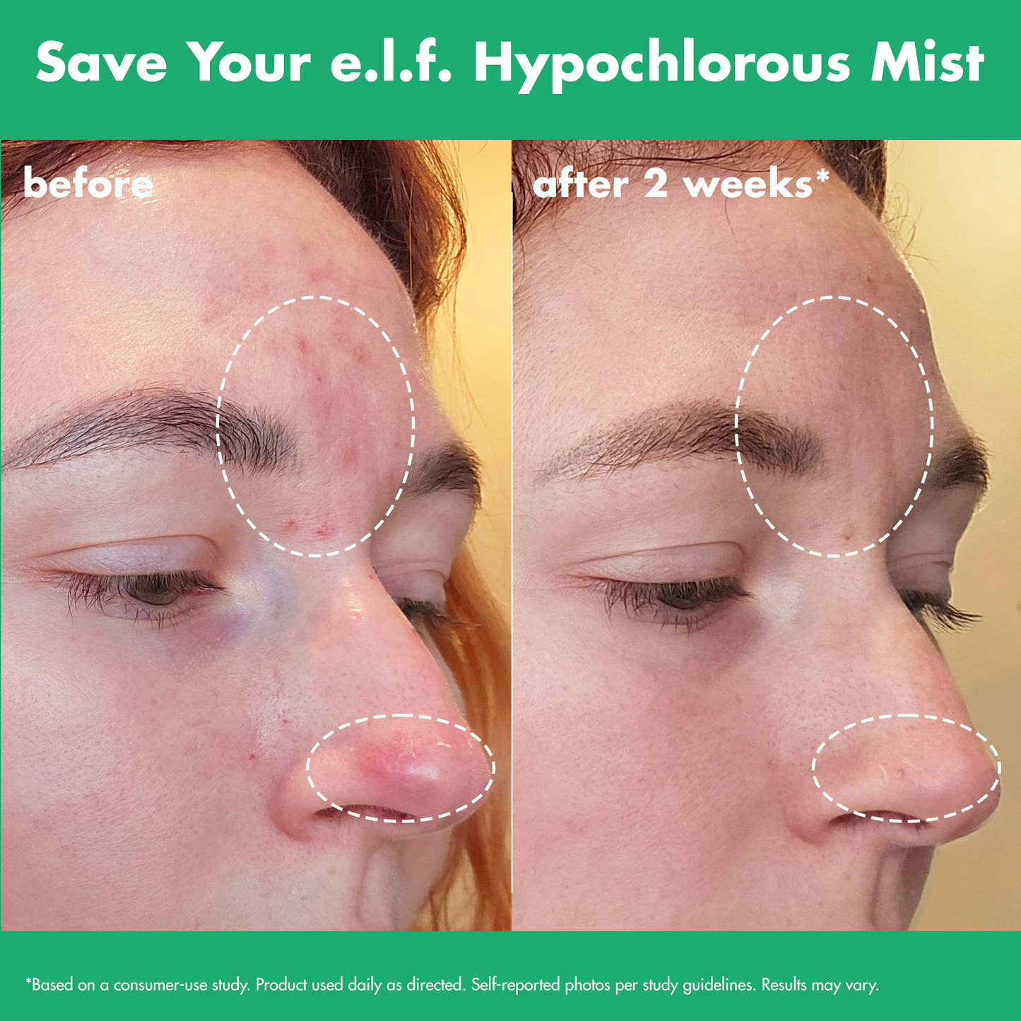 save-your-e-l-f-hypochlorous-mist-k6 FA26_EDUCATION_SAVEYOURELF_USAGE_BA1_WITHOUT_CLAIMS.png