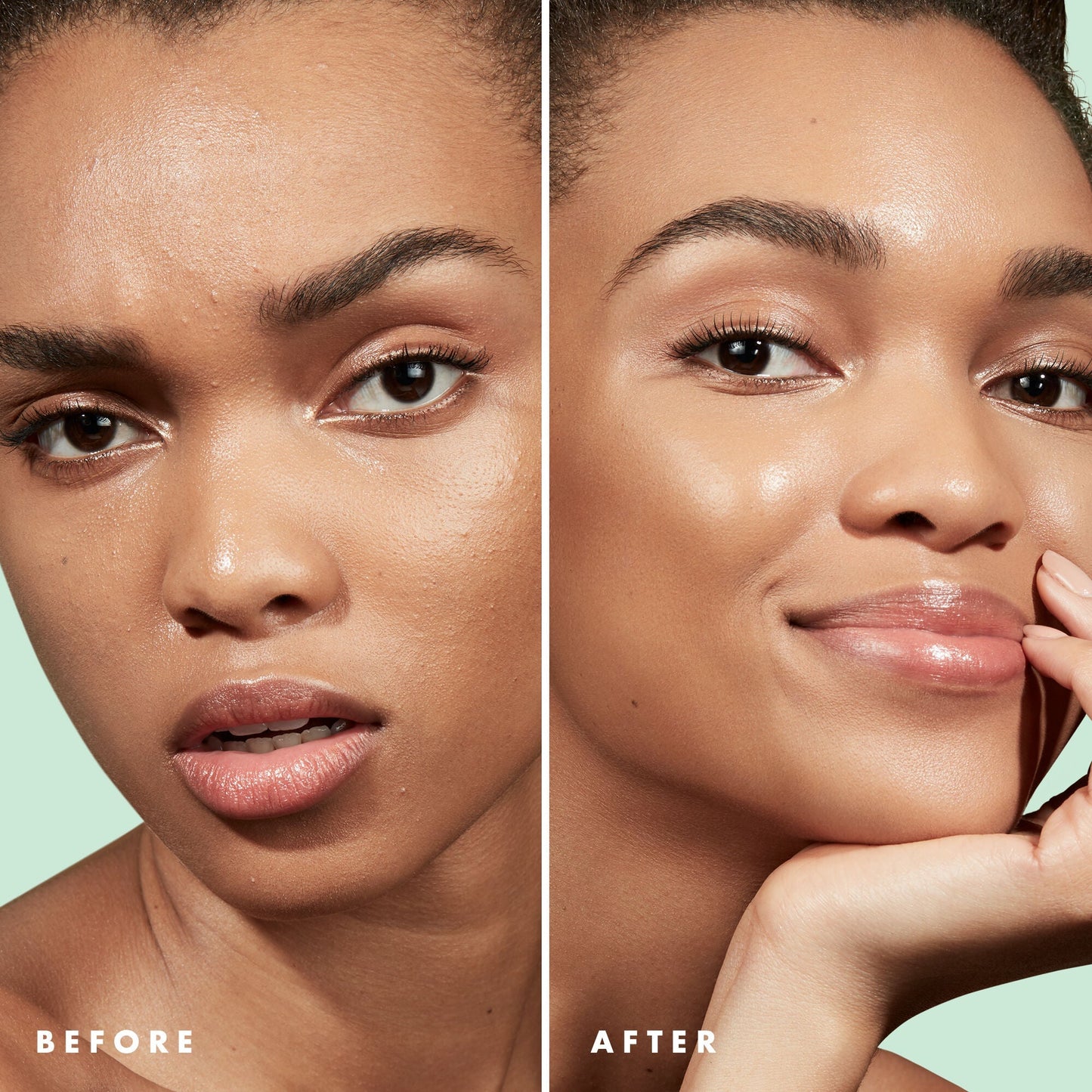 blemish-control-face-primer-small-size-f5 Primer_PP_Before_After_BlemishControl_2000x2000_1b657297-1b62-4427-874a-10c706535581.jpg